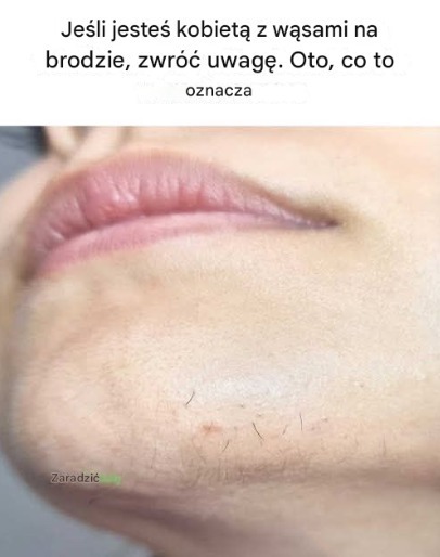Co_w_sy_podbr_dkowe_mog__powiedzie__o_Twoim_zdrowiu_-1 Co_w_sy_podbr_dkowe_mog__powiedzie__o_Twoim_zdrowiu_-1