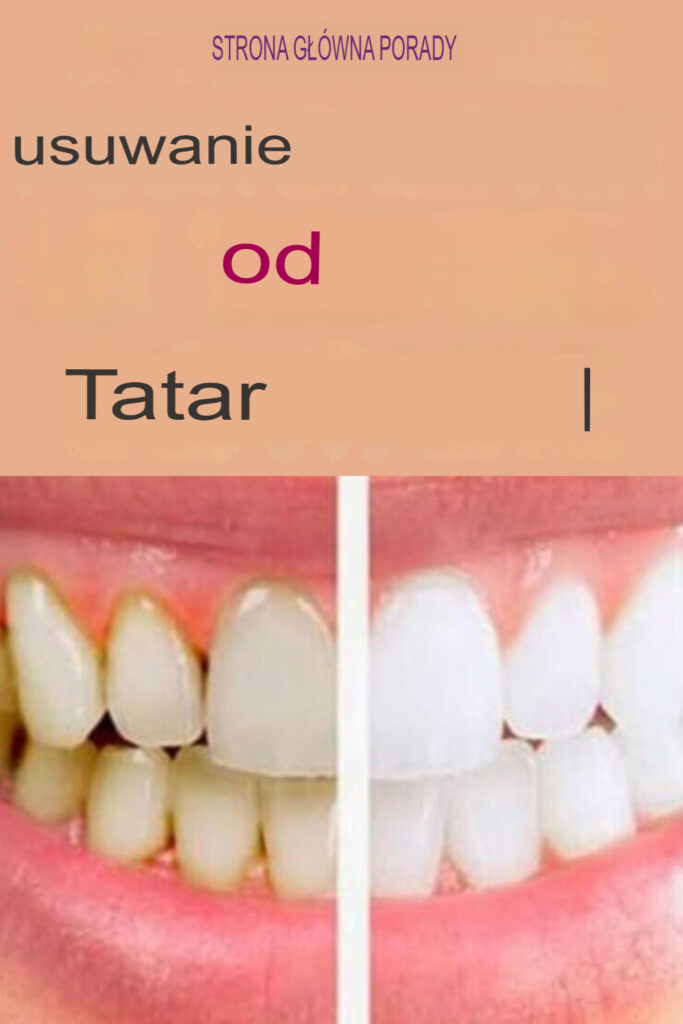 Domowy_spos_b_na_samodzielne_usuni_cie_kamienia_naz_bnego Domowy_spos_b_na_samodzielne_usuni_cie_kamienia_naz_bnego