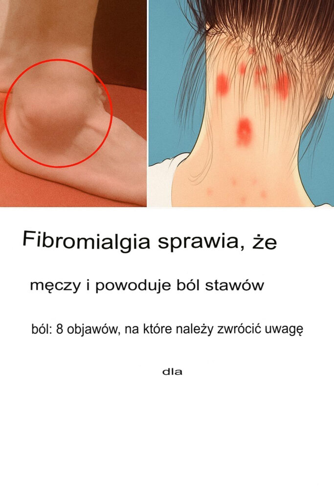 FIBROMYALGIA__choroba_niewyra_onych_emocji FIBROMYALGIA__choroba_niewyra_onych_emocji