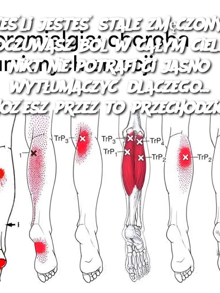 Je_li_jeste__stale_zm_czony__odczuwasz_b_l_w_ca_ym_ciele_i_nikt_nie_potrafi_Ci_jasno_wyt_umaczy__dlaczego__mo_esz_przez_to_przechodzi__