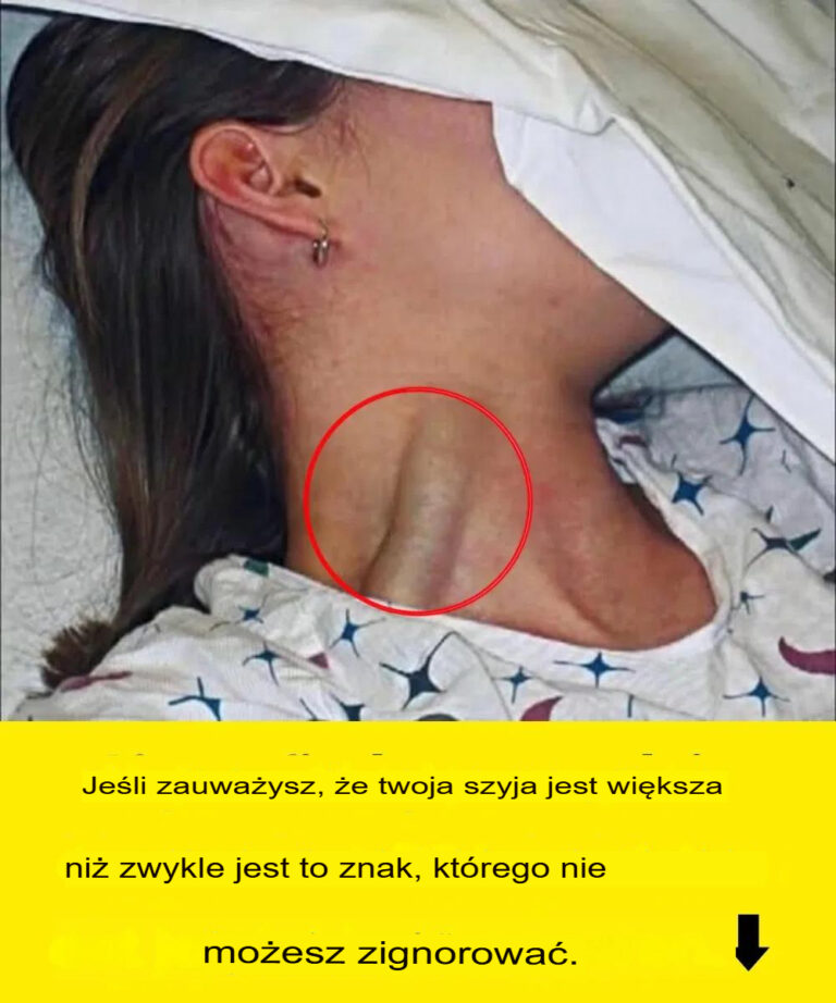 Je_li_zauwa_ysz___e_Twoja_szyja_jest_grubsza_ni__zwykle__to_znak__kt_rego_nie_mo_esz_ignorowa__