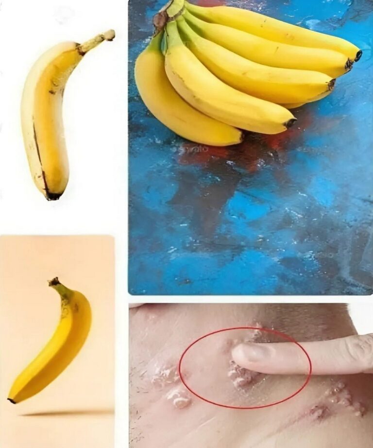 Jesz_Banany_Codziennie__Oto_Co_Dzieje_Si__Z_Twoim_Cia_em_