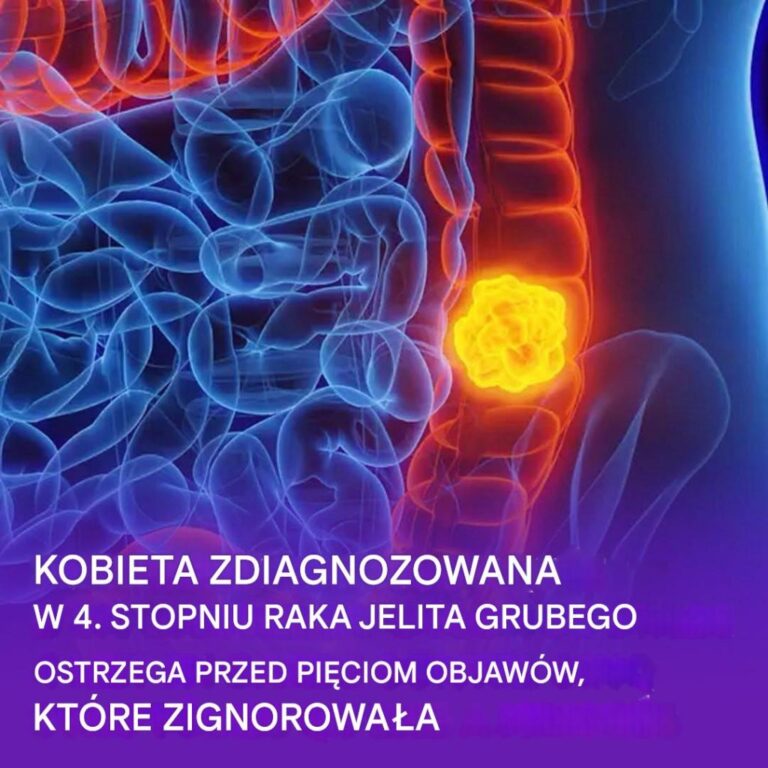 Kobieta_ujawnia_pi___objaw_w_raka_jelita_grubego__kt_rych_nie_nale_y_ignorowa_
