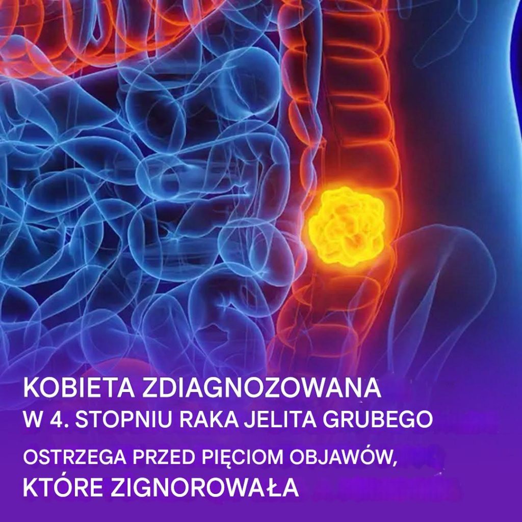 Kobieta_ujawnia_pi___objaw_w_raka_jelita_grubego__kt_rych_nie_nale_y_ignorowa_ Kobieta_ujawnia_pi___objaw_w_raka_jelita_grubego__kt_rych_nie_nale_y_ignorowa_