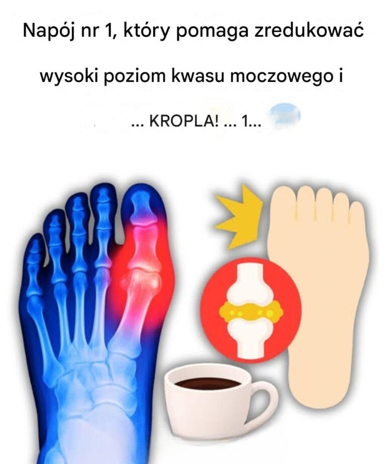 M_j_du_y_palec_u_nogi_p_on____Dop_ki_nie_odkry_em_tych_5_napoj_w__kt_re_naturalnie_eliminuj__kwas_moczowy__-1