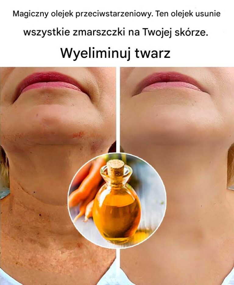 Magiczny_olejek_przeciwstarzeniowy____Ten_olejek_usunie_wszystkie_zmarszczki_z_Twojej_twarzy-1