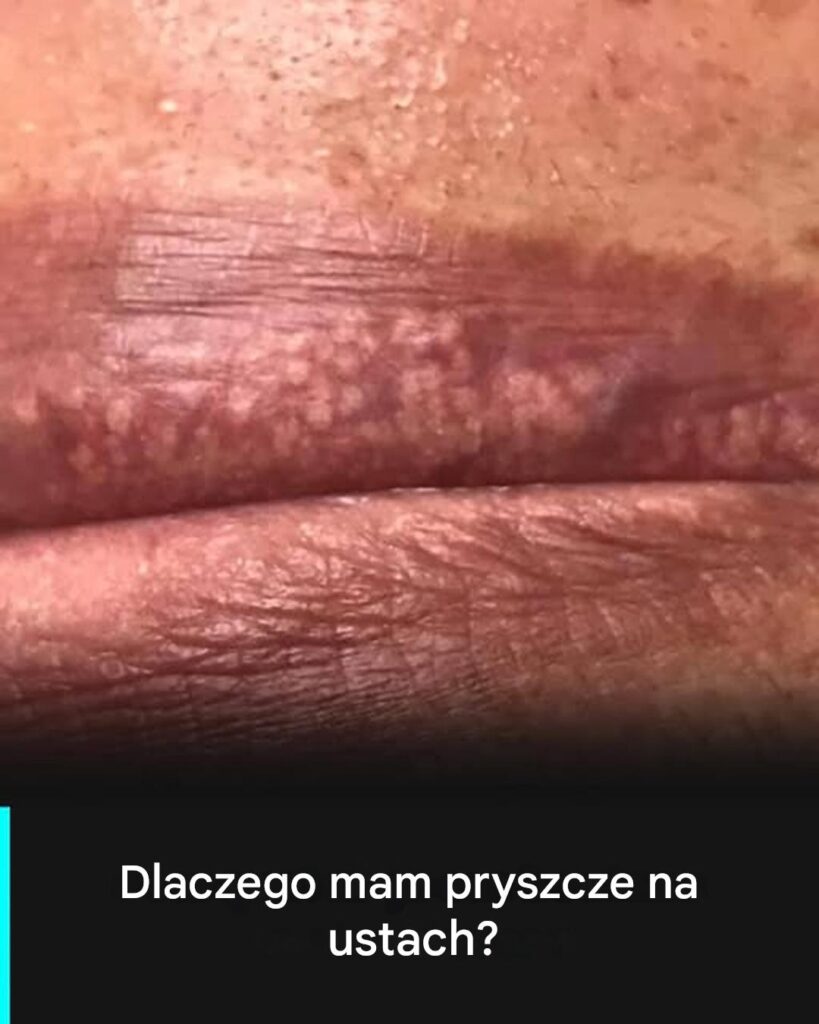 Miejsca_Fordyce__8217_a__wszystko__co_musisz_o_nich_wiedzie_ Miejsca_Fordyce__8217_a__wszystko__co_musisz_o_nich_wiedzie_