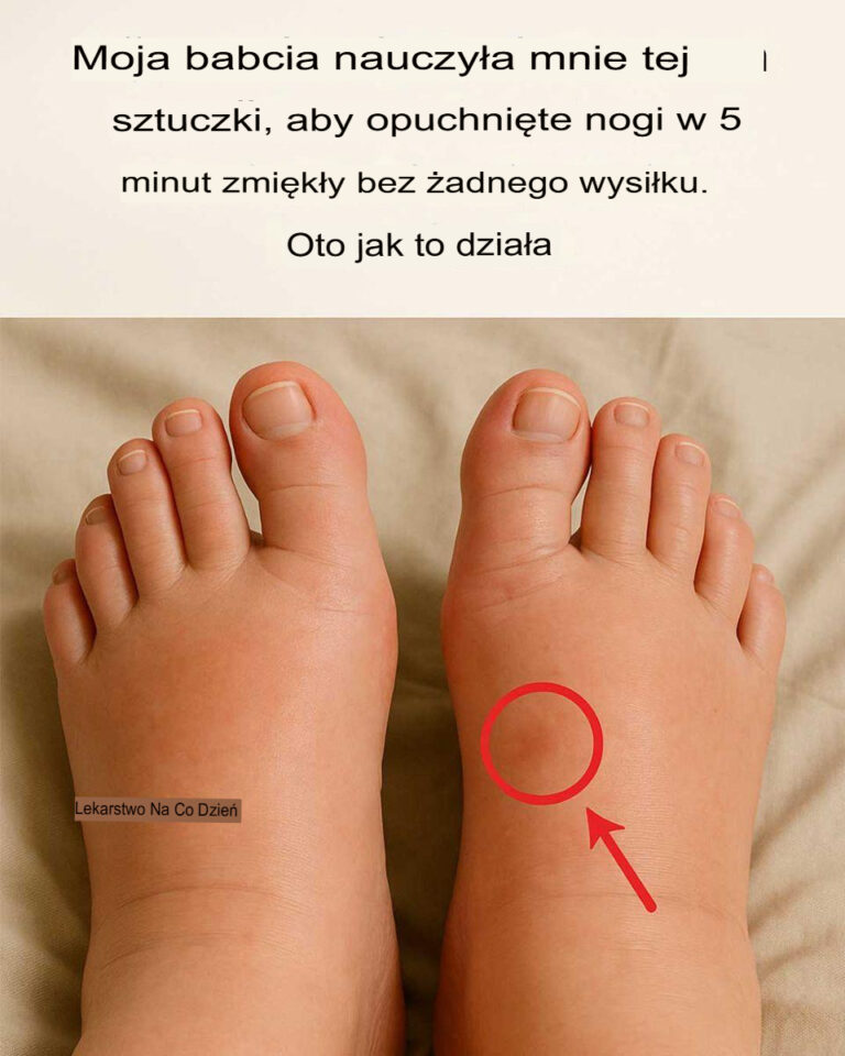 Moja_babcia_nauczy_a_mnie_tego_triku__kt_ry__agodzi_opuchlizn__st_p_w_5_minut_bez__adnego_wysi_ku__Oto_jak_to_dzia_a_