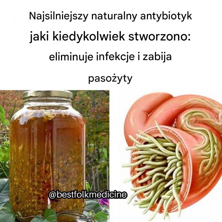 Najsilniejszy_naturalny_antybiotyk__jaki_kiedykolwiek_stworzono__eliminuje_infekcje_i_zabija_paso_yty-2 Najsilniejszy_naturalny_antybiotyk__jaki_kiedykolwiek_stworzono__eliminuje_infekcje_i_zabija_paso_yty-2