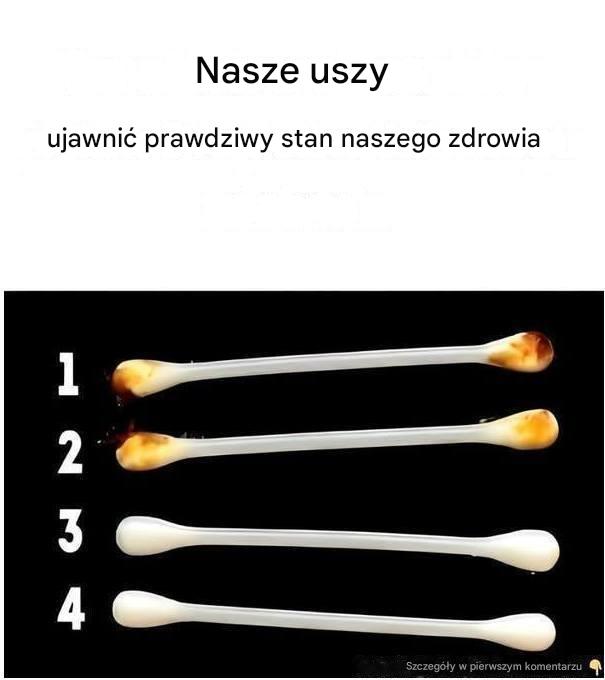 Nasze_uszy_ujawniaj__prawdziwy_stan_naszego_zdrowia Nasze_uszy_ujawniaj__prawdziwy_stan_naszego_zdrowia