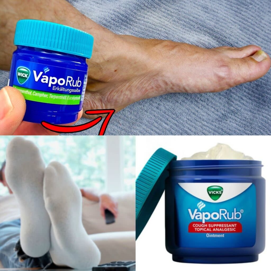 Nigdy_nie_s_dzi_am___e_b_d__go_u_ywa__w_ten_spos_b______NIEWIARYGODNY_efekt_______VapoRub_na_stopy_
