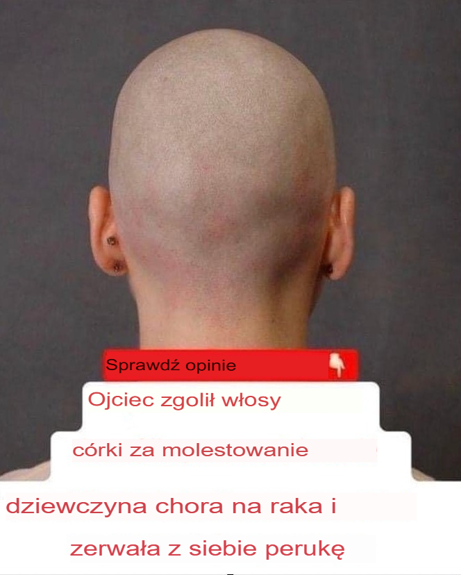 Ojciec_goli_g_ow__c_rki_po_tym__jak_na_miewa_a_si__z_dziewczyny_chorej_na_raka_i_poci_gn__a_j__za_peruk_ Ojciec_goli_g_ow__c_rki_po_tym__jak_na_miewa_a_si__z_dziewczyny_chorej_na_raka_i_poci_gn__a_j__za_peruk_