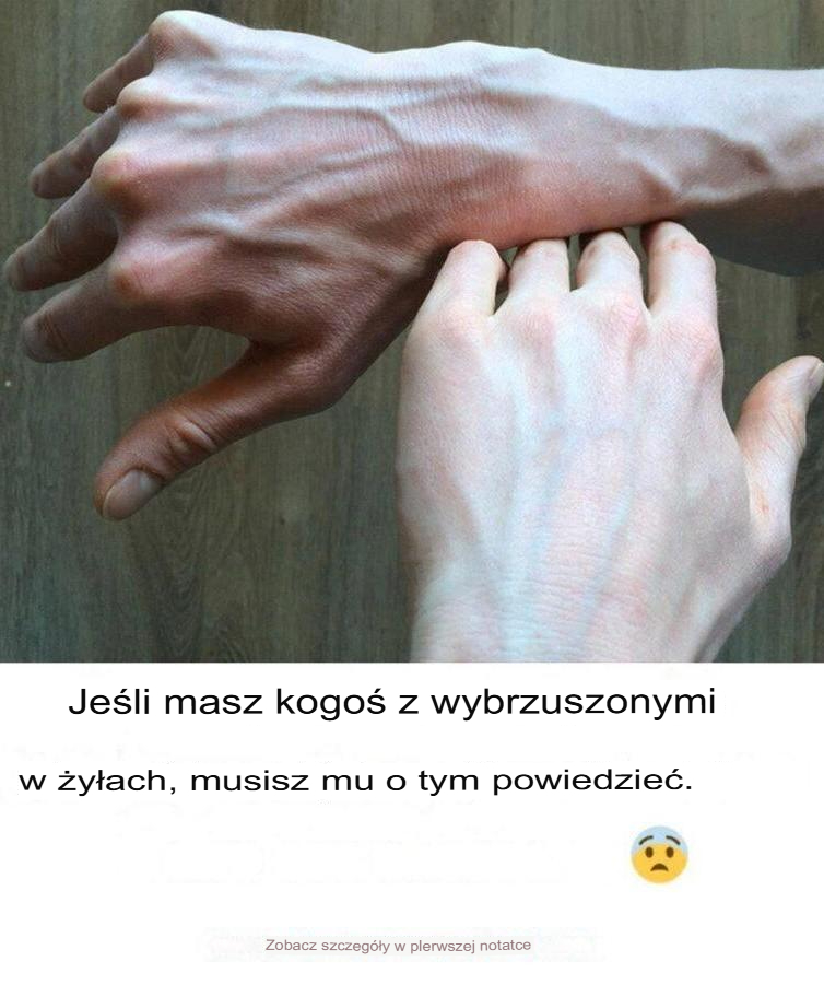 Osoba_z_wypuk_ymi__y_ami Osoba_z_wypuk_ymi__y_ami