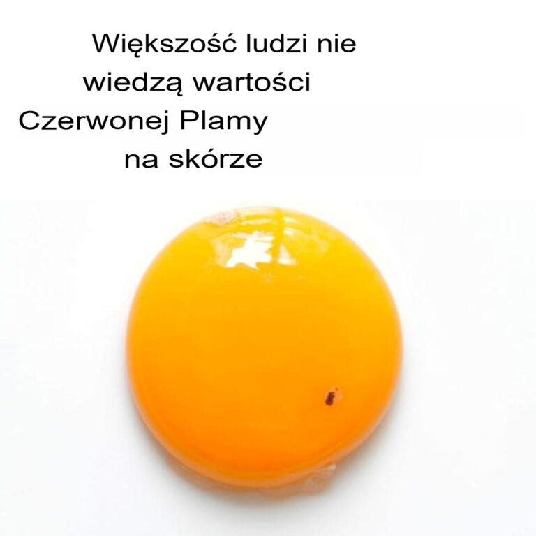 Oto_co_oznacza__gdy_jajko_zawiera_czerwon__plamk_