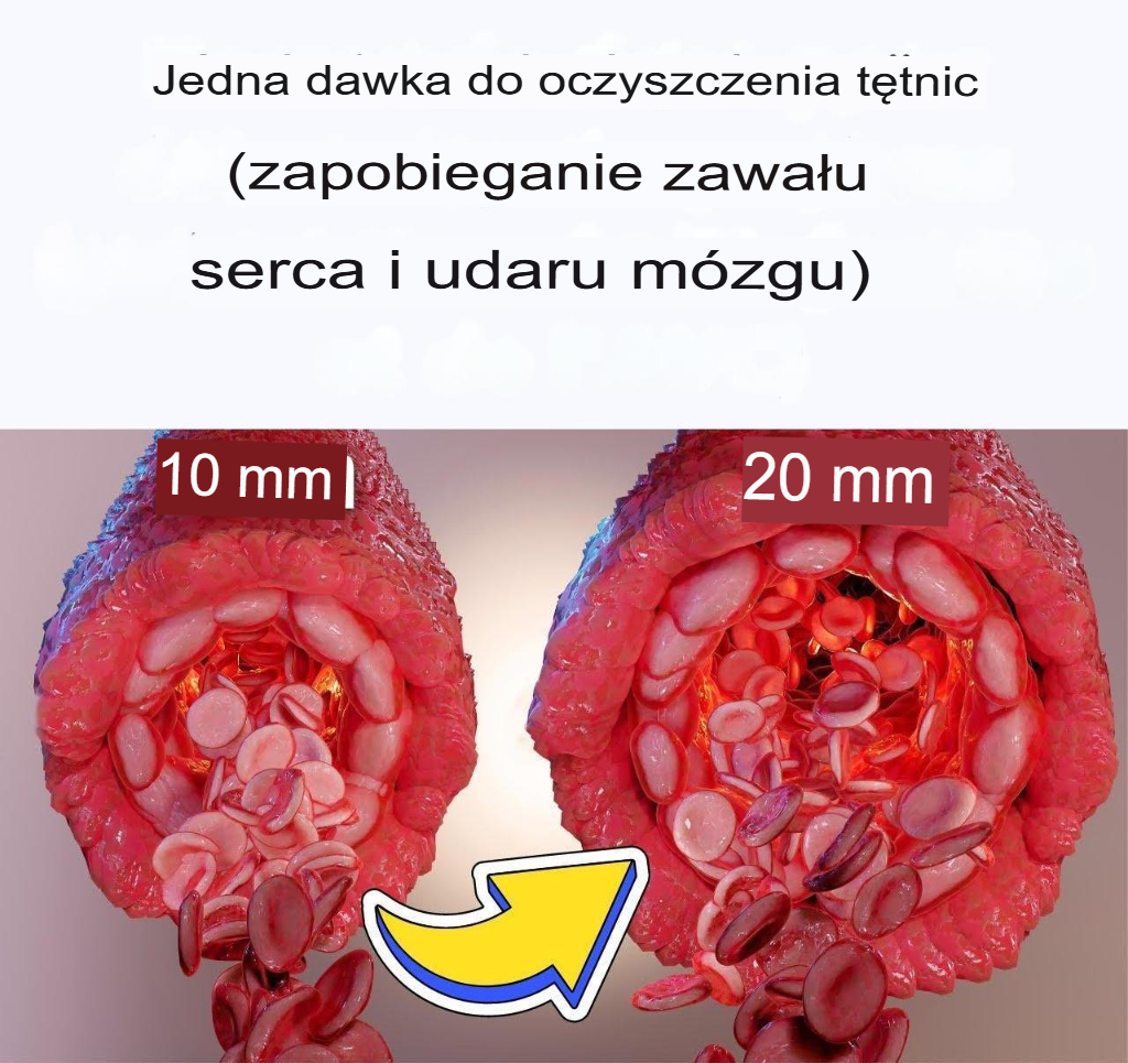 Pojedyncza_dawka_oczyszczaj_ca_t_tnice__zapobiegaj_ca_zawa_owi_serca_i_udarowi_m_zgu_ Pojedyncza_dawka_oczyszczaj_ca_t_tnice__zapobiegaj_ca_zawa_owi_serca_i_udarowi_m_zgu_
