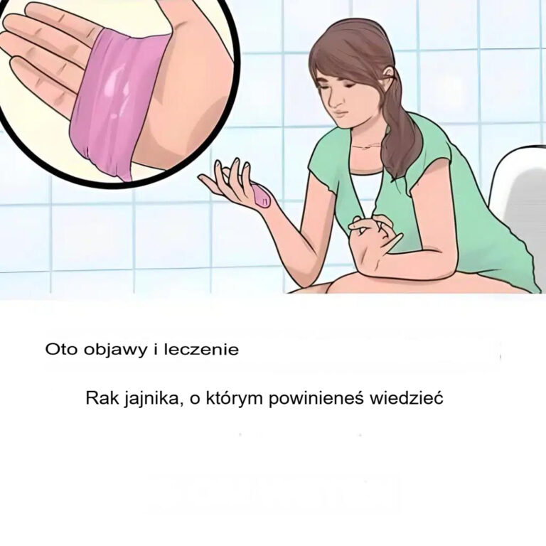 Rak_jajnika__Oto_najcz_stsze_wczesne_objawy