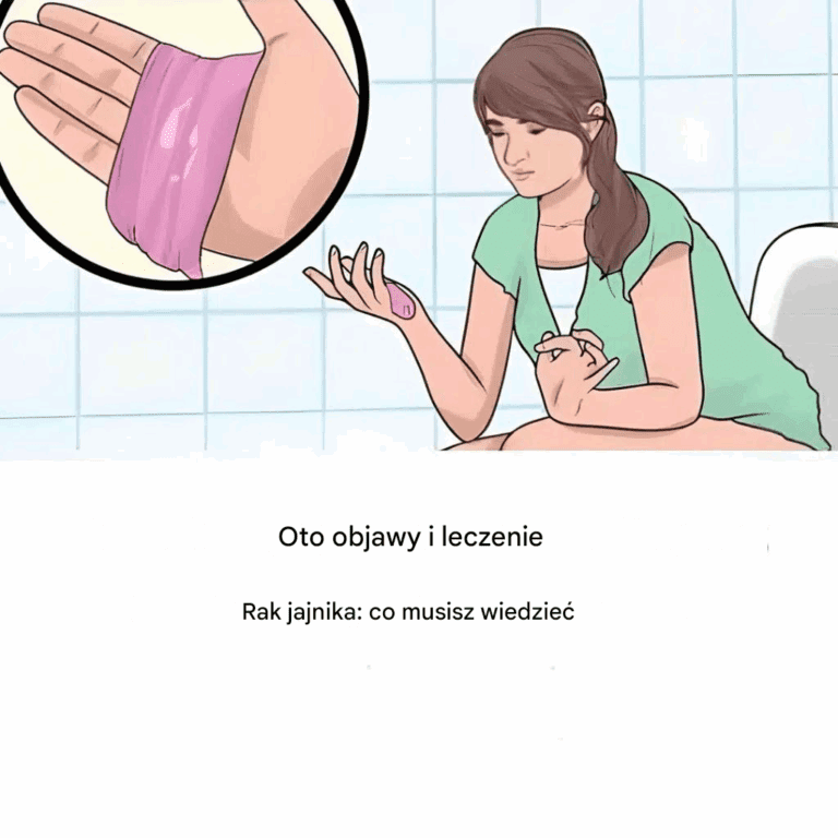 Rak_jajnika__Oto_najcz_stsze_wczesne_objawy