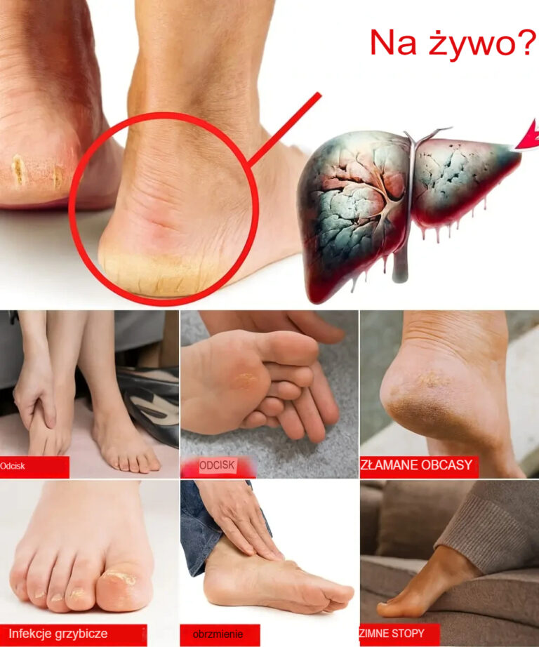 Sekrety__kt_re_Twoje_stopy_pr_buj__Ci_powiedzie___6_ostrzegawczych_sygna__w_zdrowotnych__kt_rych_nie_nale_y_ignorowa_