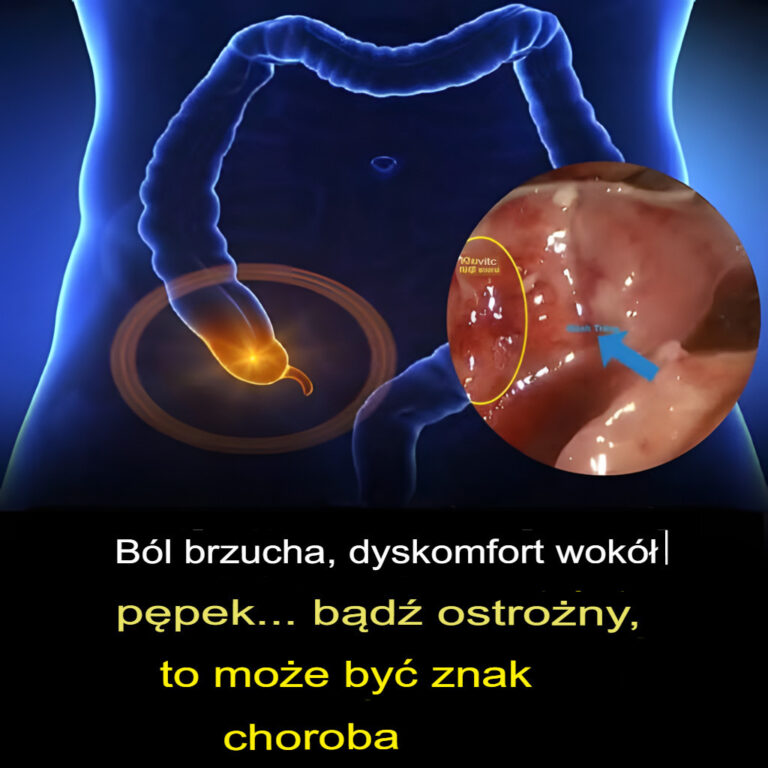 T_py_b_l_brzucha__b_l_brzucha_w_okolicy_p_pka__Oto__co_musisz_wiedzie__