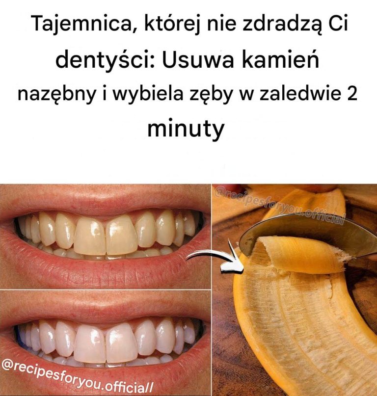 Tajemnica__kt_rej_nie_zdradz__Ci_denty_ci__Usuwa_kamie__naz_bny_i_wybiela_z_by_w_zaledwie_2_minuty-1