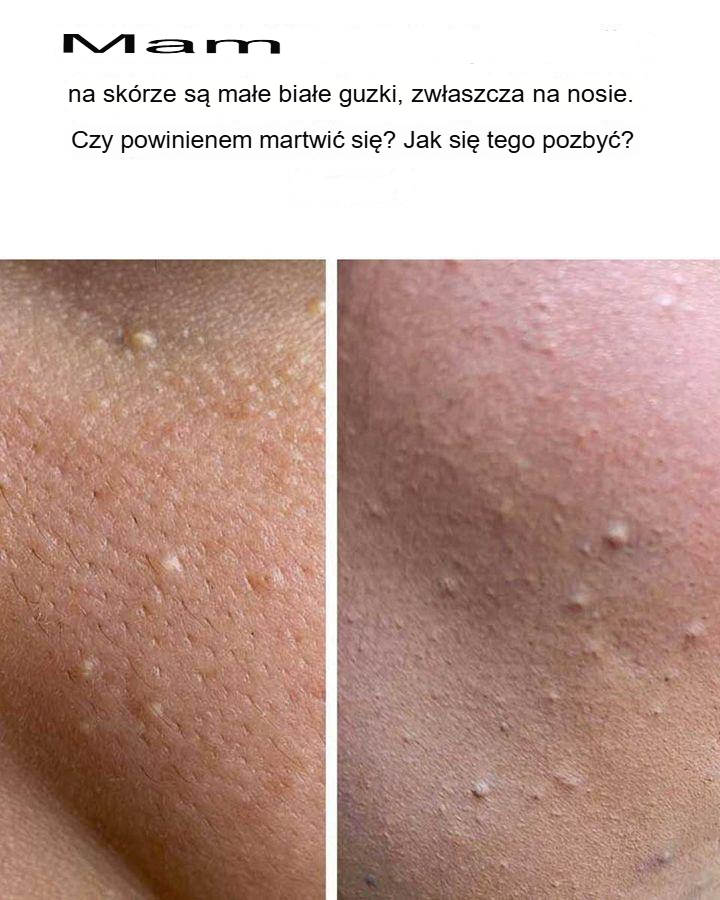 To_mnie_naprawd__wkurza_ To_mnie_naprawd__wkurza_