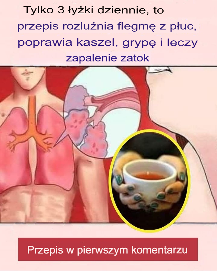 Tylko_3__y_ki_sto_owe_dziennie_rozrzedzaj__flegm__z_p_uc___agodz__kaszel__gryp__i_lecz__zapalenie_zatok Tylko_3__y_ki_sto_owe_dziennie_rozrzedzaj__flegm__z_p_uc___agodz__kaszel__gryp__i_lecz__zapalenie_zatok