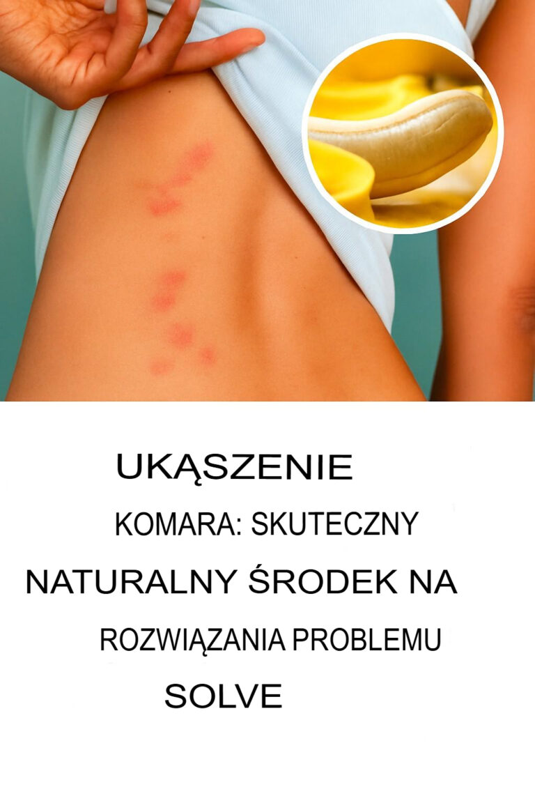 Uk_szenia_komar_w__Skuteczny_naturalny_spos_b_na_rozwi_zanie_problemu
