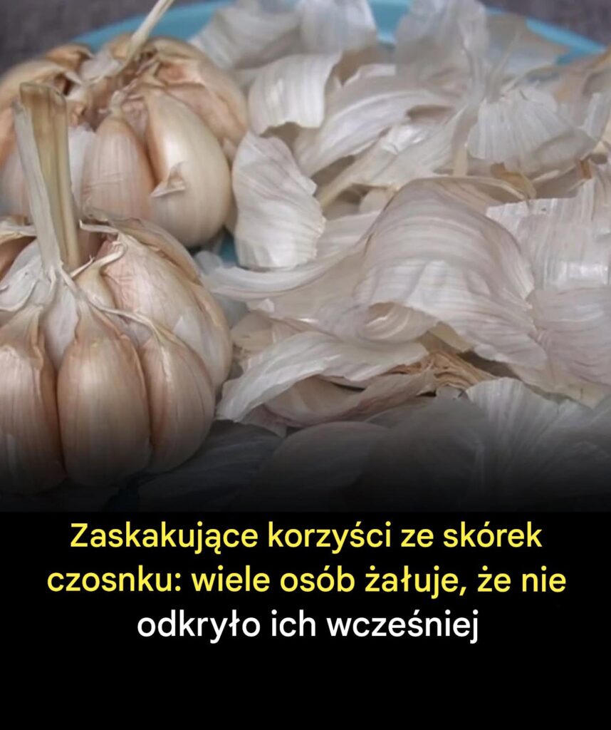 Zaskakuj_ce_korzy_ci_ze_sk_rek_czosnku Zaskakuj_ce_korzy_ci_ze_sk_rek_czosnku