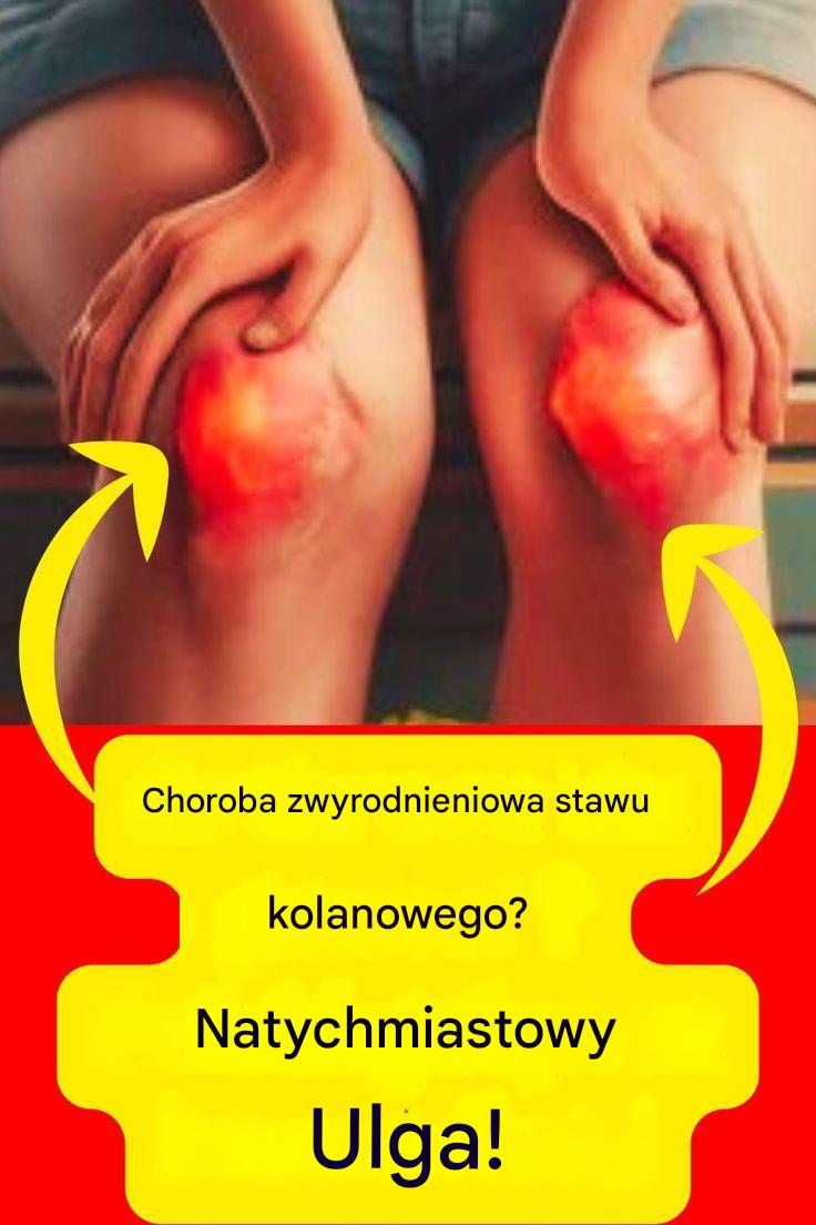 agodne_odci__enie_kolan__10_wskaz_wek_sprawdzonych_przez_ekspert_w_ds__zdrowia