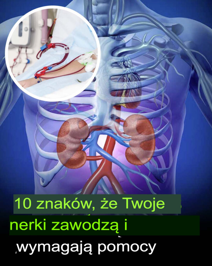 10_Oznak___e_Twoje_Nerki_S__Zagro_one__Nie_Ignoruj_Tych_Sygna__w