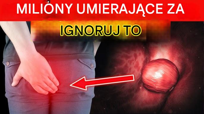 10_cichych_objaw_w_raka_jelita_grubego__kt_re_ignorujesz-3 10_cichych_objaw_w_raka_jelita_grubego__kt_re_ignorujesz-3