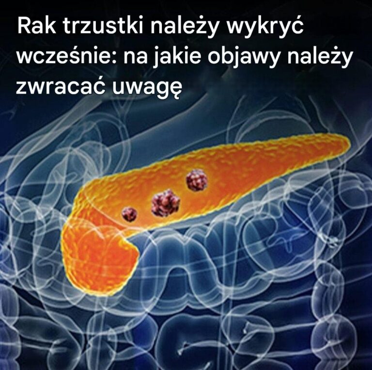 10_mo_liwych_objaw_w_raka_trzustki__kt_re_koniecznie_musisz_zna_