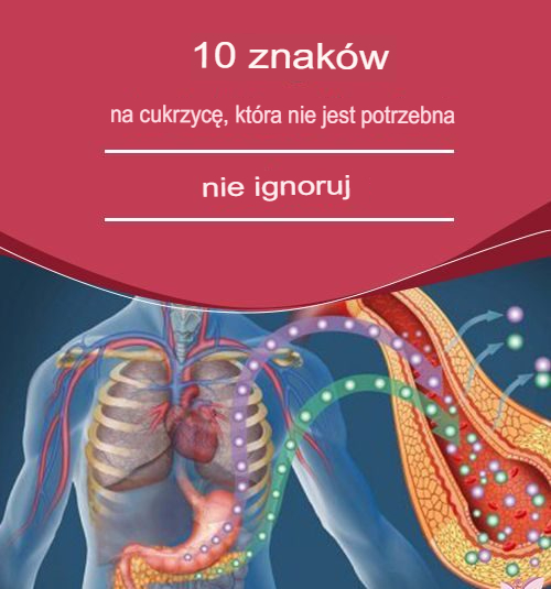10_objaw_w_cukrzycy__kt_rych_nie_nale_y_ignorowa__Zobacz_pe_ne_szczeg__y_w_pierwszym_komentarzu 10_objaw_w_cukrzycy__kt_rych_nie_nale_y_ignorowa__Zobacz_pe_ne_szczeg__y_w_pierwszym_komentarzu