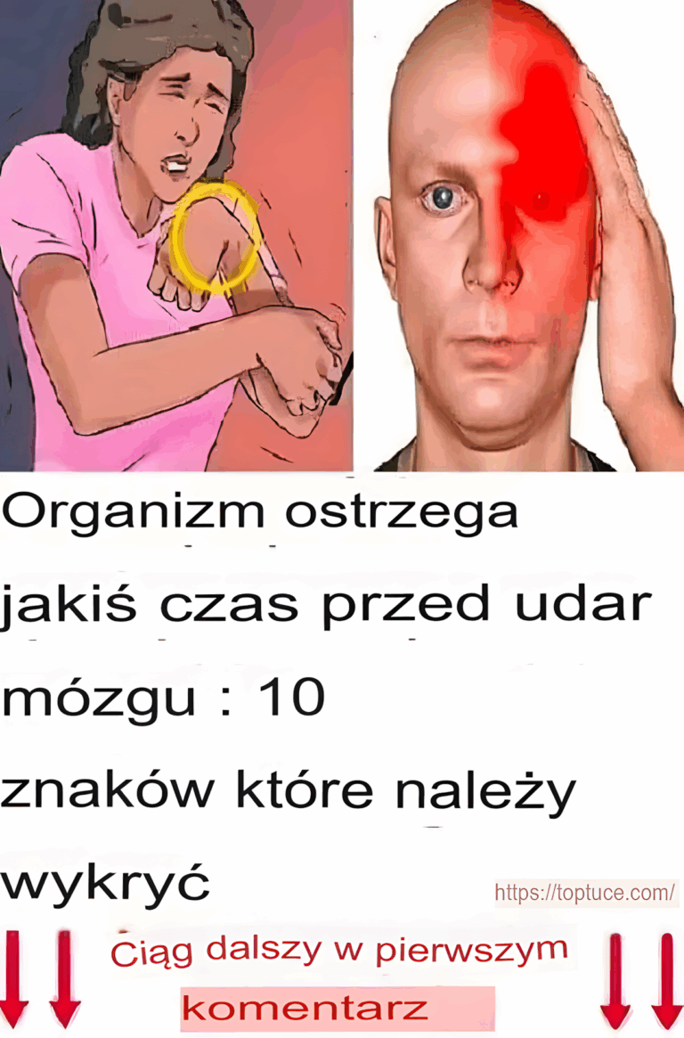 10_objaw_w_udaru_m_zgu__na_kt_re_nale_y_zwr_ci__uwag__u_bliskich