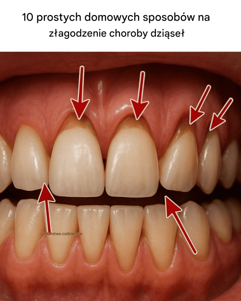 10_prostych_domowych_sposob_w_na_z_agodzenie_choroby_dzi_se_ 10_prostych_domowych_sposob_w_na_z_agodzenie_choroby_dzi_se_