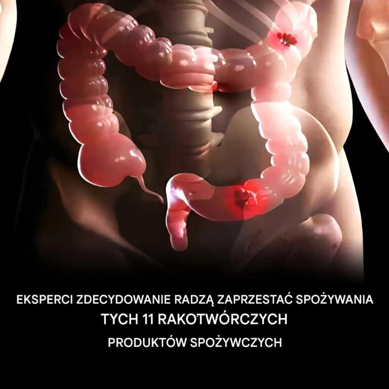 11_codziennych_produkt_w_spo_ywczych__kt_rych_nale_y_unika__wed_ug_nauki__Czarna_lista_dietetyk_w