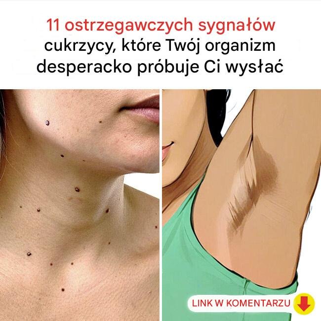 11_pomara_cza 11_pomara_cza