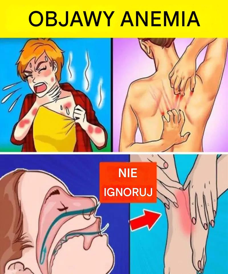12_cichych_objaw_w_ANEMII__kt_rych_nie_nale_y_ignorowa_-1 12_cichych_objaw_w_ANEMII__kt_rych_nie_nale_y_ignorowa_-1