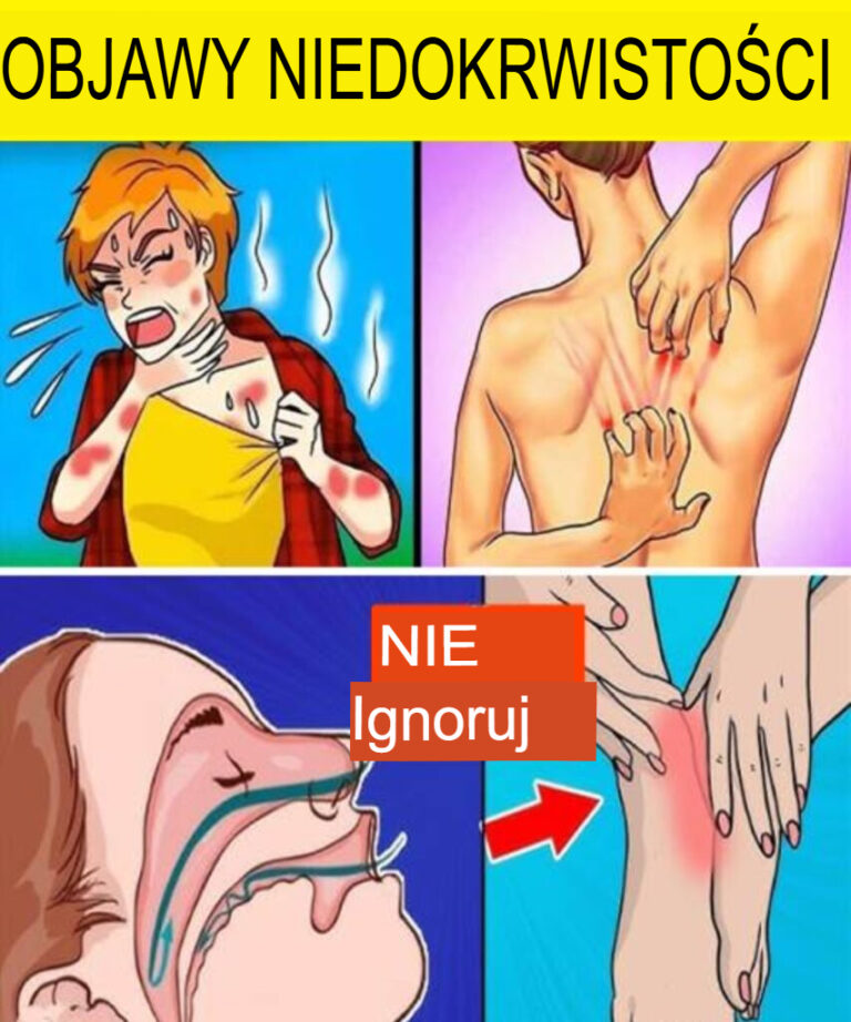 12_cichych_objaw_w_anemii__kt_rych_nie_nale_y_ignorowa_