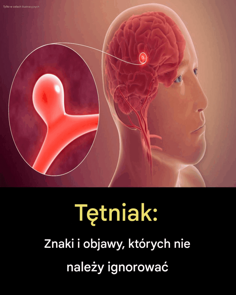 12_ostrzegawczych_objaw_w_t_tniaka__kt_rych_nie_nale_y_ignorowa_ 12_ostrzegawczych_objaw_w_t_tniaka__kt_rych_nie_nale_y_ignorowa_