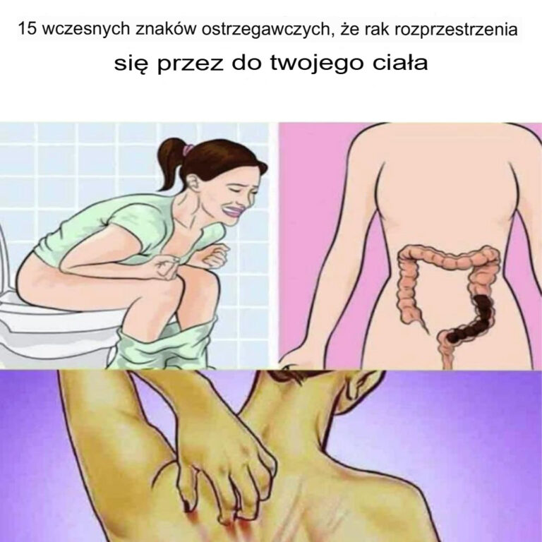 15_typowych_objaw_w_raka