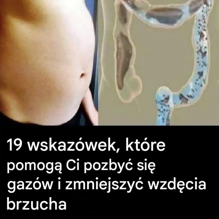 19_naturalnych_wskaz_wek__jak_z_agodzi__wzd_cia_i_uzyska__lekki__o__dek