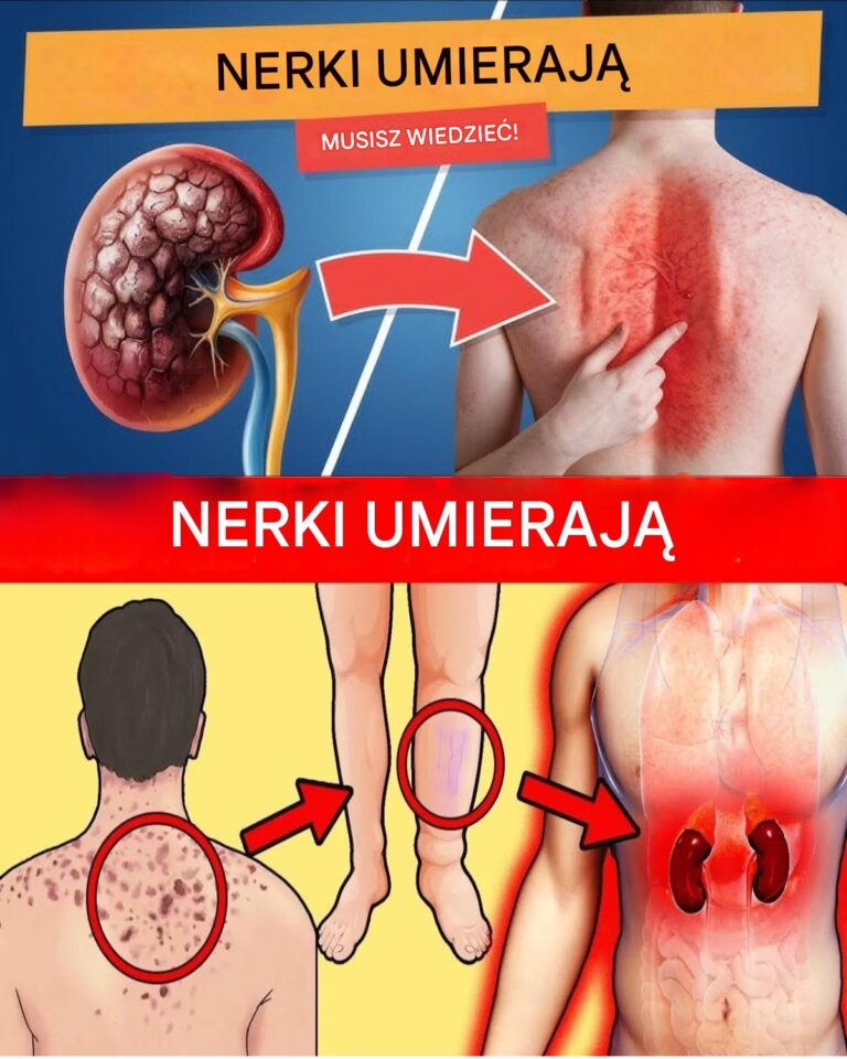 23_dziwne_objawy_choroby_nerek__kt_rych_mo_esz_nie_zauwa_y_