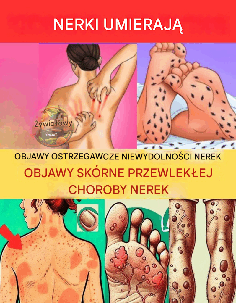 23_dziwne_objawy_choroby_nerek__kt_rych_wi_kszo___ludzi_nie_zauwa_a___dop_ki_nie_jest_za_p__no-2