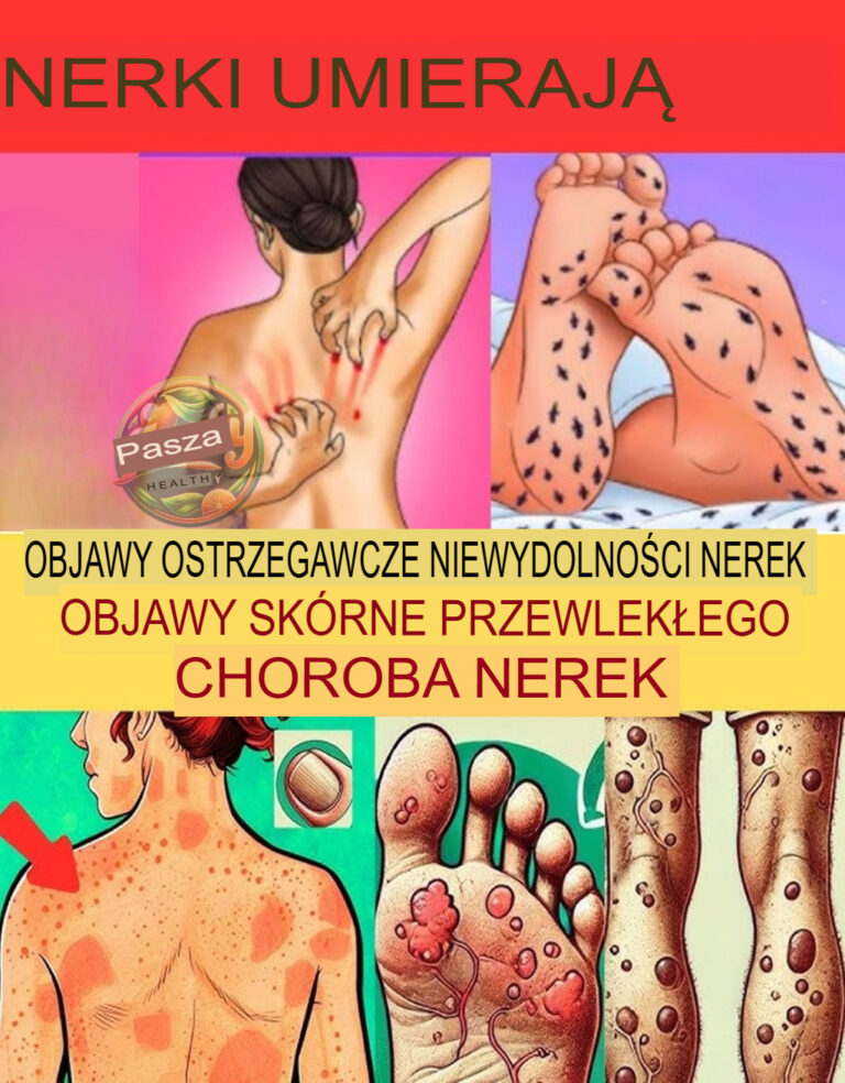 23_dziwne_objawy_choroby_nerek__kt_rych_wi_kszo___ludzi_nie_zauwa_a___dop_ki_nie_jest_za_p__no