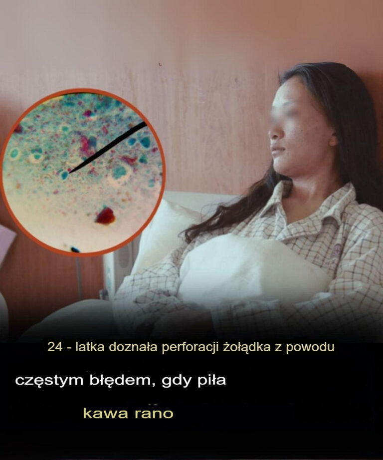 24_letnia_kobieta_dozna_a_perforacji__o__dka_w_wyniku_cz_stego_b__du_podczas_picia_porannej_kawy