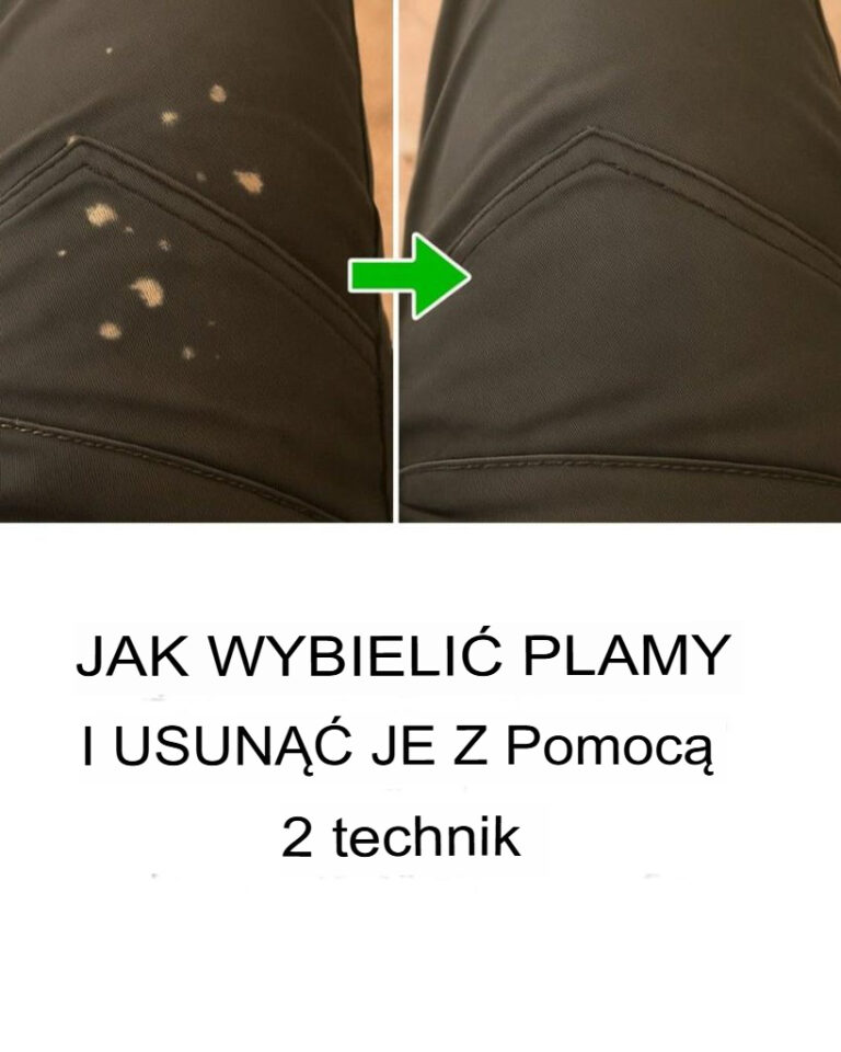 2_proste_sposoby_na_trwa_e_usuni_cie_plam_z_wybielacza_z_ubra_