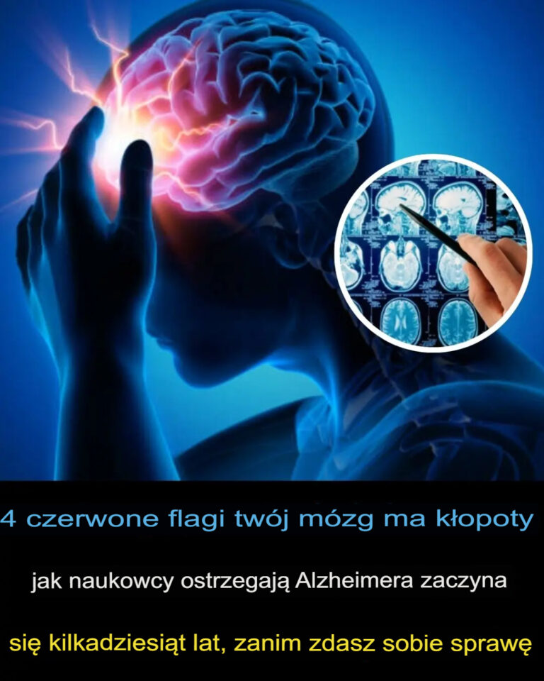 4_czerwone_flagi__kt_re_mog__wskazywa__na_problemy_z_m_zgiem___ostrzegaj__eksperci_Choroba_Alzheimera_mo_e_rozpocz___si__na_dziesi_tki_lat_przed_pojawieniem_si__objaw_w