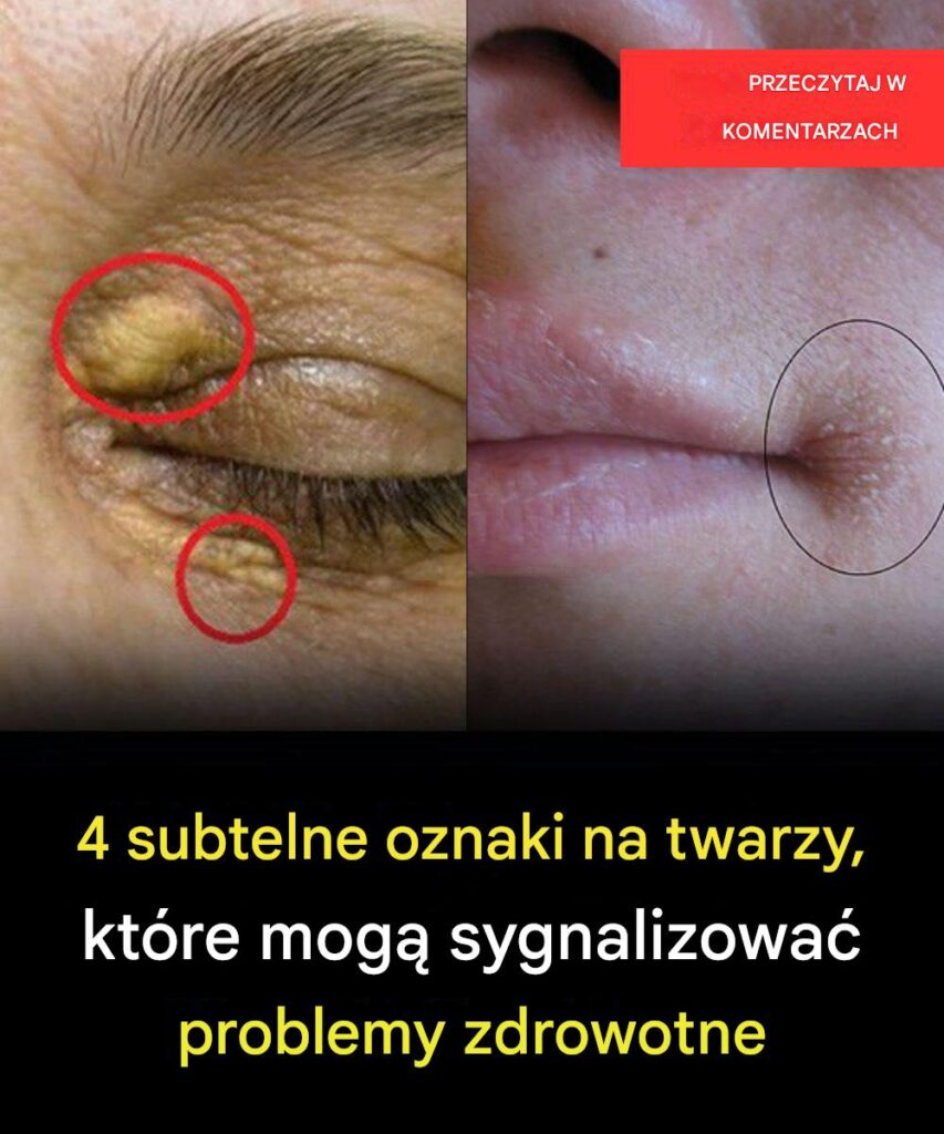 4_subtelne_oznaki_na_twarzy__kt_re_mog__sygnalizowa__problemy_zdrowotne 4_subtelne_oznaki_na_twarzy__kt_re_mog__sygnalizowa__problemy_zdrowotne