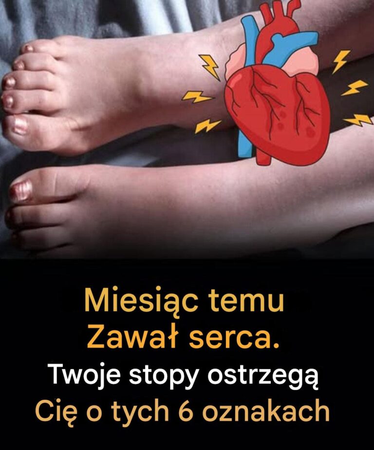 6_cichych_oznak_w_stopach__kt_re_mog__ostrzega__przed_zawa_em_serca_na_kilka_tygodni_przed_zawa_em